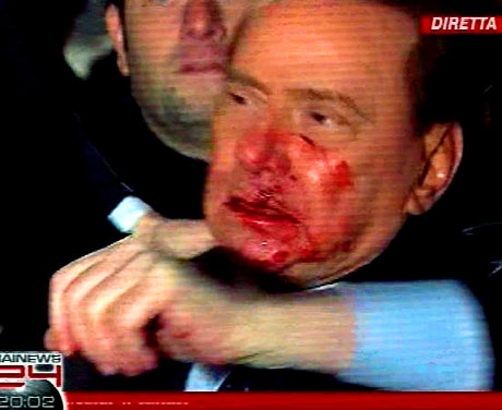 Berlusconi'nin burnunu kırdılar! galerisi resim 10