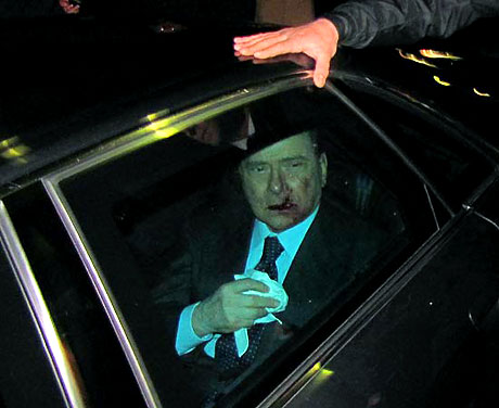 Berlusconi'nin burnunu kırdılar! galerisi resim 11