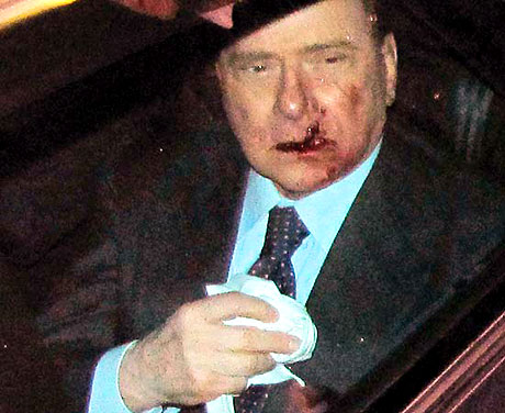 Berlusconi'nin burnunu kırdılar! galerisi resim 12