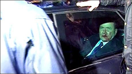 Berlusconi'nin burnunu kırdılar! galerisi resim 15
