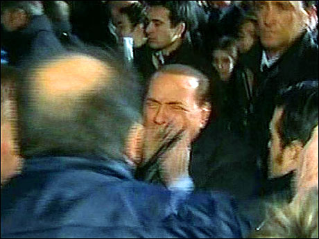 Berlusconi'nin burnunu kırdılar! galerisi resim 17