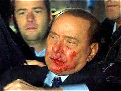 Berlusconi'nin burnunu kırdılar! galerisi resim 18