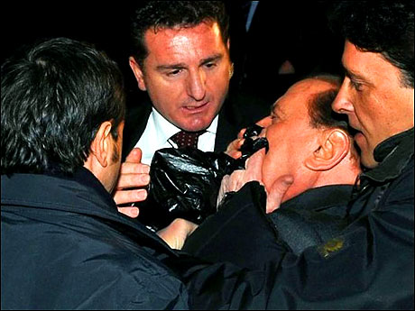 Berlusconi'nin burnunu kırdılar! galerisi resim 20