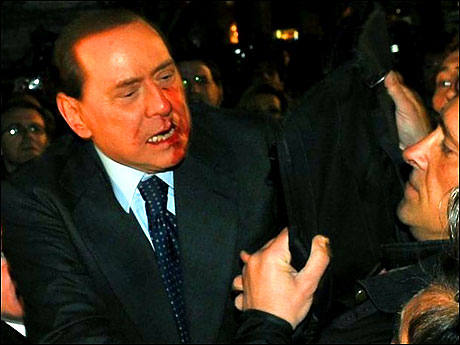 Berlusconi'nin burnunu kırdılar! galerisi resim 21