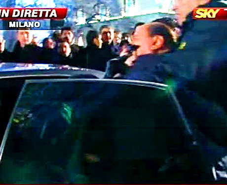 Berlusconi'nin burnunu kırdılar! galerisi resim 7