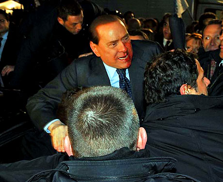 Berlusconi'nin burnunu kırdılar! galerisi resim 8