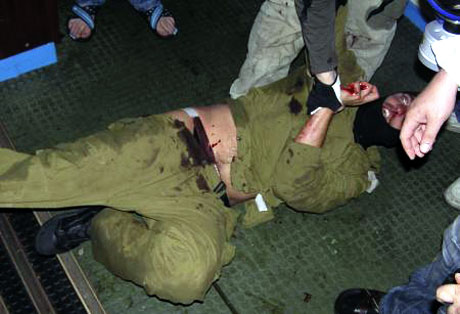 İsrail'in imajı yerlerde: Ağlayan komando! galerisi resim 4