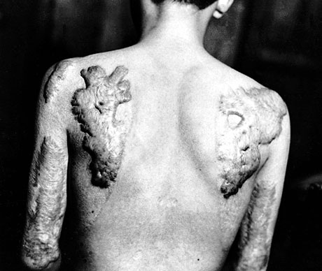 65 yıl önce yaşanan felaket galerisi resim 30