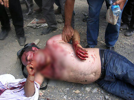 'Canlı Kalkanlara' sert müdahale galerisi resim 11