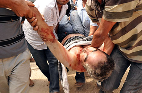 'Canlı Kalkanlara' sert müdahale galerisi resim 12