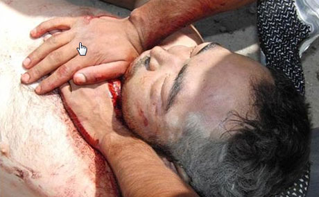 'Canlı Kalkanlara' sert müdahale galerisi resim 9