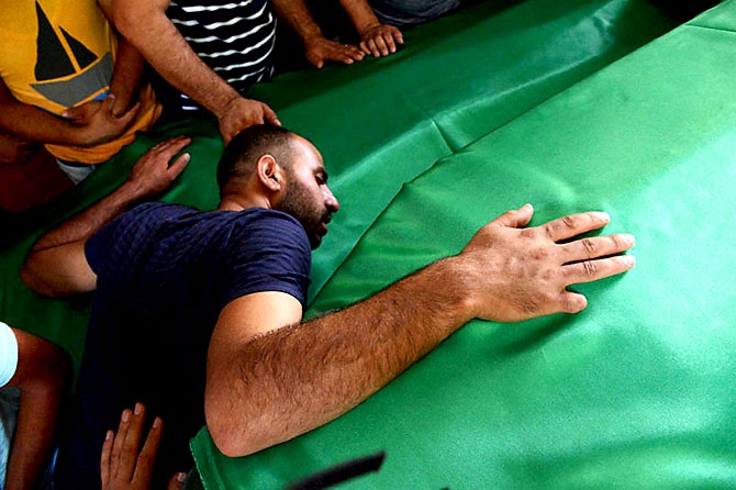 Antep'te bombalı saldırı: En az 50 kişi hayatını kaybetti galerisi resim 42