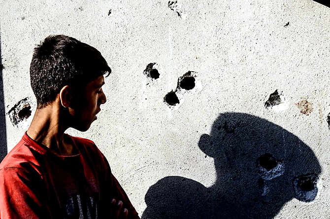 Antep'te bombalı saldırı: En az 50 kişi hayatını kaybetti galerisi resim 79