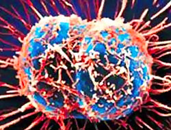 Prostat kanseri hücresini öldüren virüs!