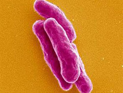 Tüberküloz yeniden hortladı