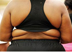 72 milyondan fazla ABD'li obez!..