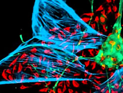 Kök hücrede yeni dönem!