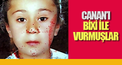 Canan’ı bixi ile vurmuşlar