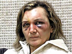 Türkiye'de kadın olmak