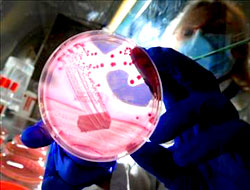 Ölümcül bakterinin yeni adresi!