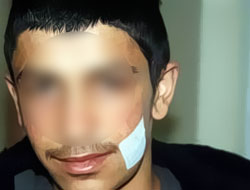 Kürt çocukların güvercin tedirginliği!