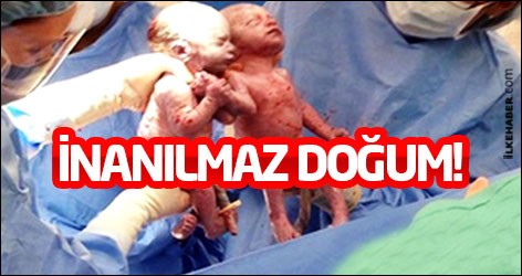 İnanılmaz doğum!