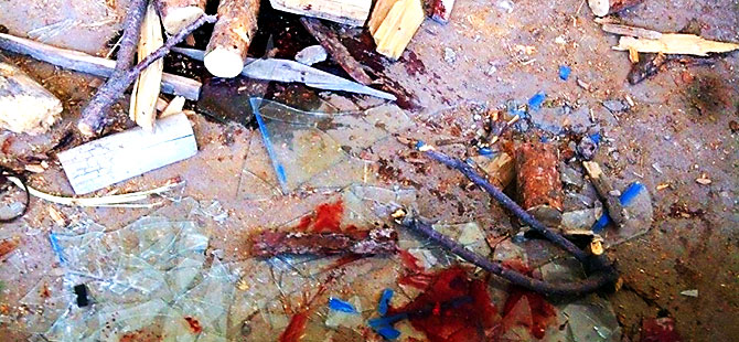 DİHA: Özel harekât timleri iki çocuk öldürdü!