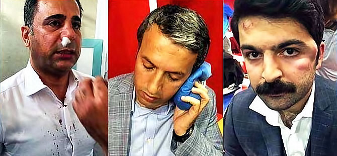 Amedspor'dan saldırı açıklaması: Burası Türkiye'nin başkenti Ankara