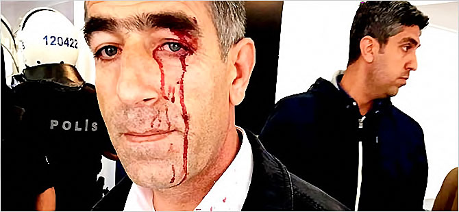 Spor Bakanı: Amedspor’un başına gelenler siyasete çekilmemeli