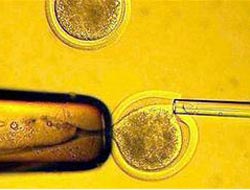 Kök hücre çalışmasında önemli dönemeç