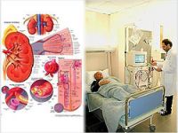 Böbrek hastaları için sevindirici haber