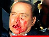 Berlusconi'nin Burnunu Kırdılar